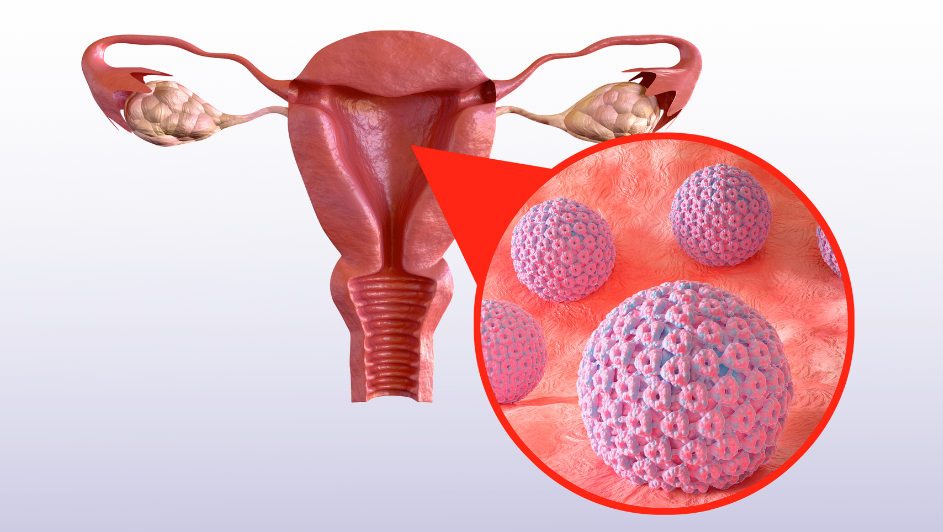 HPV چیست