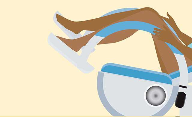 نمونه گیری آزمایش پاپ اسمیر