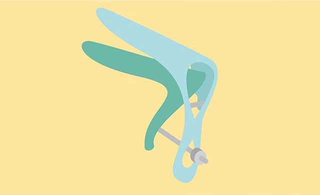 نمونه گیری آزمایش پاپ اسمیر