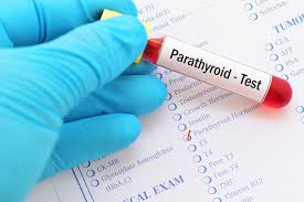 تشخیص اختلالات غدد پاراتیروئید