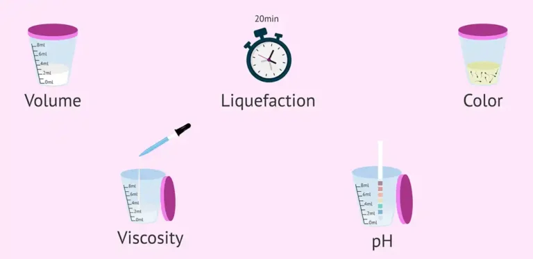 اسپرموگرام چگونه است